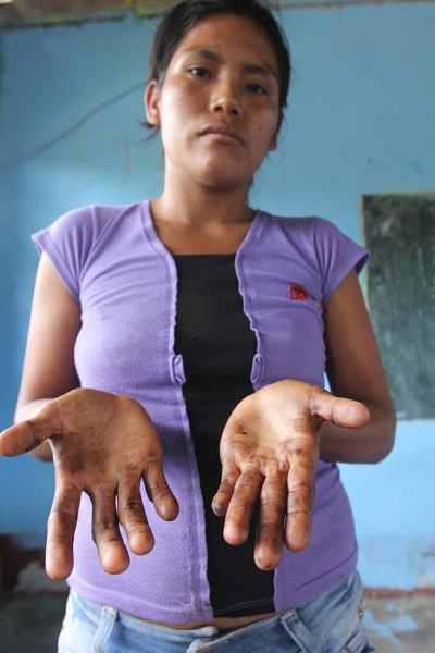 More than a week after collecting oil from river with no protective gear, Elizabeth Atuash, 22, of the Awajún village of Nazareth still has stained hands. Photo credit: Barbara Fraser.